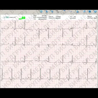 Программное обеспечение для электрокардиографии LUMED ECG MANAGER