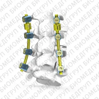 Система остеосинтеза для грудопоясничнокрестцовой зоны BDyn