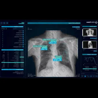 Медицинское программное обеспечение DR Chest