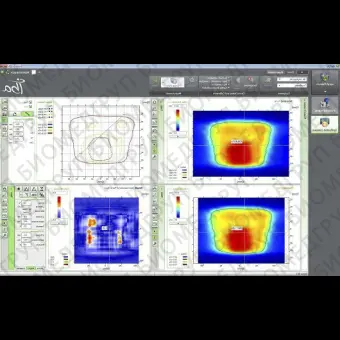 Программное обеспечение для радиационной терапии MyQA Patients