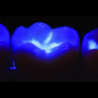 Насадка блэклайт VALO Blacklight для опред флуорисценц. композитов