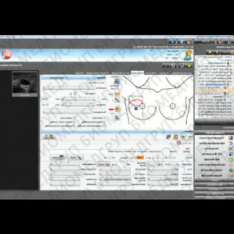 Программное обеспечение для гинекологического обследования NEXUS / OBSTETRICS