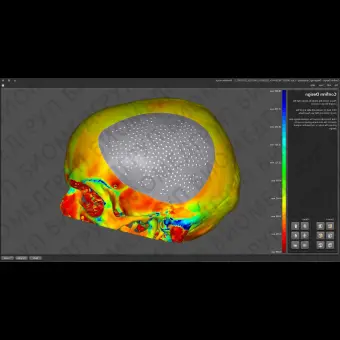 Программное обеспечение для челюстнолицевой хирургии ADEPT CMF
