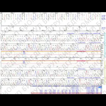 Программное обеспечение для последовательности оснований в ДНК Mutation Surveyor