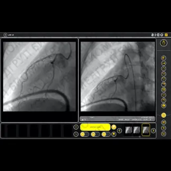 Программное обеспечение для медицинских снимков ODIS