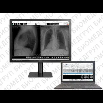 Медицинское программное обеспечение Med Diag