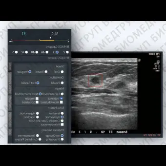Программное обеспечение для ультразвуковых исследований BRFHUS FreeHand ABUS system