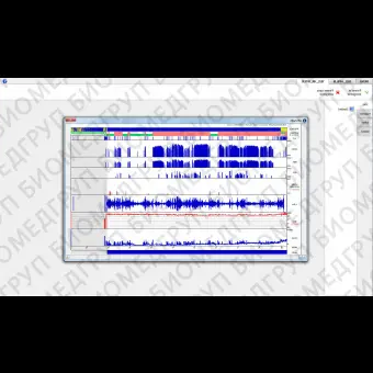 Программное обеспечение для полисомнографии