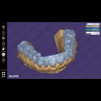 Exocad Bite Splint Module  модуль для создания терапевтических капп