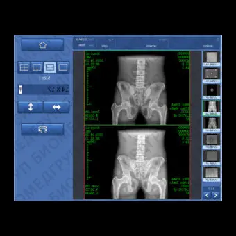 Программное обеспечение для медицинских снимков DXRay