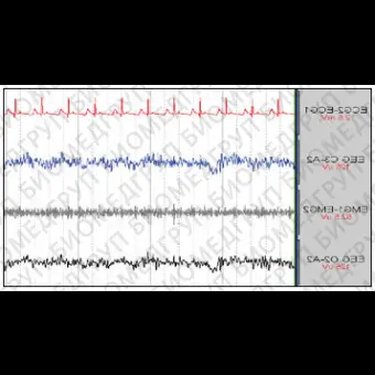 Медицинское программное обеспечение ECG Free