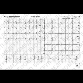 Ветеринарная ЭКГсистема 12 каналов