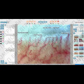 Капилляроскоп видео DM04
