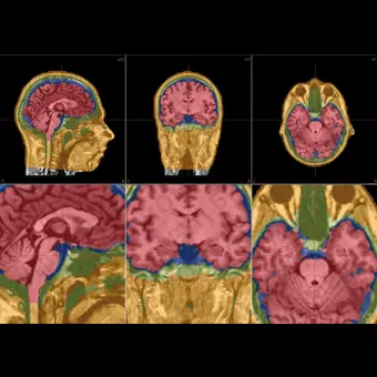 Программное обеспечение для ЭКГ MRI 3.0