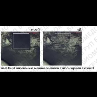 Массспектрометр МАЛДИ, до 500 кДа, точность до 2 ppm, разрешение по массам до 25000 FWHM, с рефлектроном, ячейкой соударений, с TOF системой, высокопроизводительный, напольный, MALDI7090, Shimadzu, MALDI7090