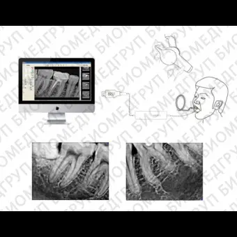 Интраоральный плоскопанельный детектор для стоматологической радиографии FOX 600
