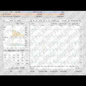 Программное обеспечение для диагностики