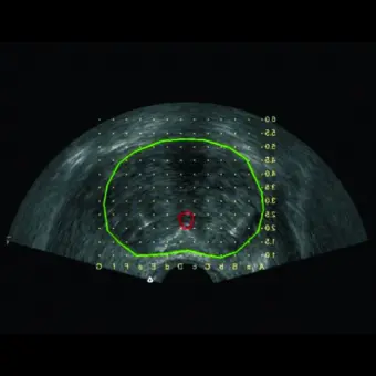 Ультразвуковой сканер переносной, с тележкой Apogee 2300 Urology