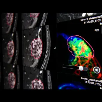 Клиническое программное обеспечение Brainlab Elements