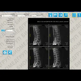 Программное обеспечение для медицинских снимков iQVIEW BASIC