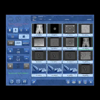 Программное обеспечение для медицинских снимков DXRay