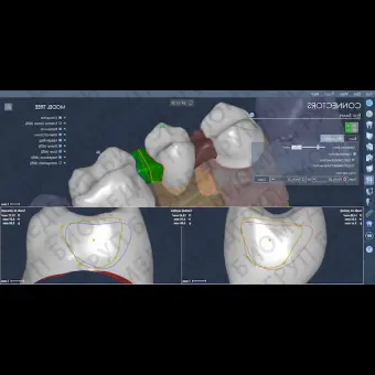 Программное обеспечение для стоматологии CAD LYNX