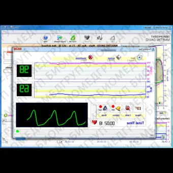 Программное обеспечение для пульсового оксиметра SpiroConnect