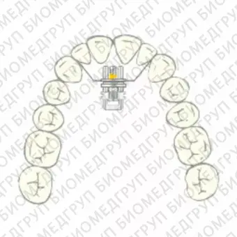 Винт Vector 440R, micro винт расширяющий, секторальный изогнутый SD