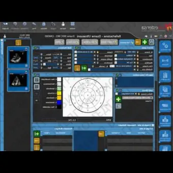 Программное обеспечение для кардиологии SUITESTENSA CVIS PACS