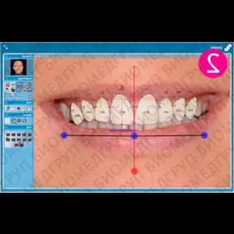 Программное обеспечение для стоматологии Planmeca Romexis Smile Design