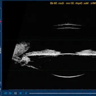 Accutome by Keeler UBM Plus Ультразвуковое оборудование