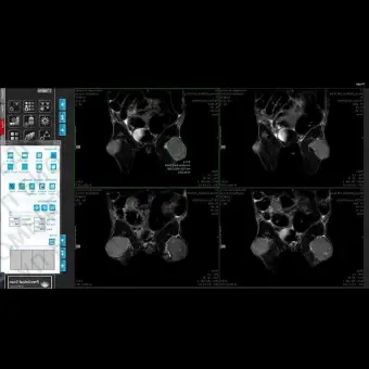 Доклиническое программное обеспечение Preclinical Scan