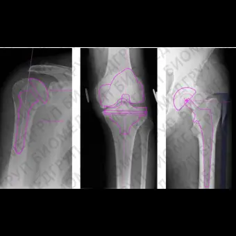 Медицинское программное обеспечение OrthoView