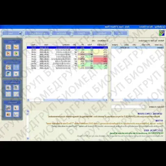 Сердечная системы картографии HeartVUE