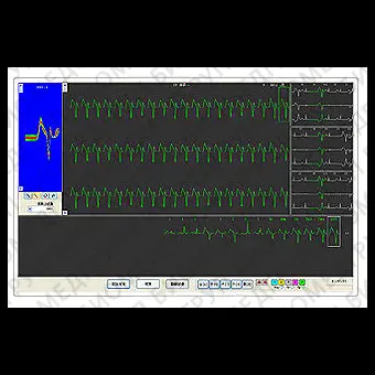 Медицинское программное обеспечение AFib Detection