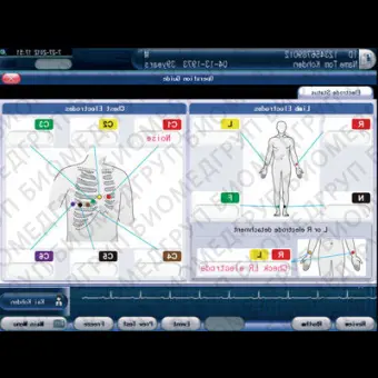 Электрокардиограф для спокойного состояния Cardiofax G