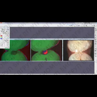 Программное обеспечение для обработки снимков зубов DBSWIN