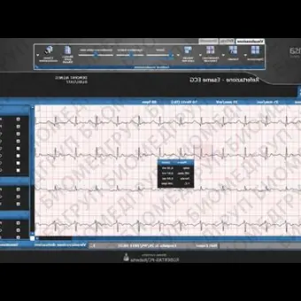 Программное обеспечение для кардиологии SUITESTENSA CVIS PACS