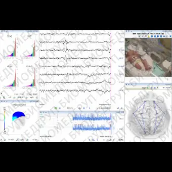 ЭЭГсистема 64 канала BE Plus LTM