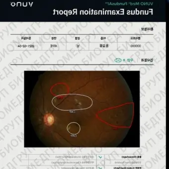 Программное обеспечение для офтальмоскопии MedFundus AI