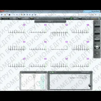 Регистратор ЭКГ 12 каналов CardioMobile 12