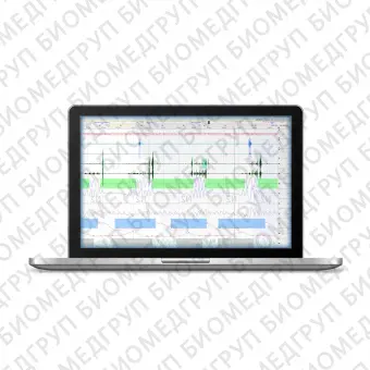 Программное обеспечение для лаборатории сна DOMINO