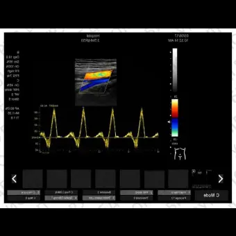 Ультразвуковой сканер на платформе DC6000 PLUS