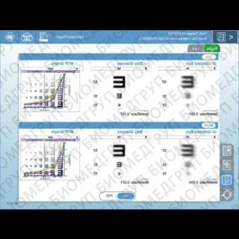 Роговичный топограф OPDScan III VS