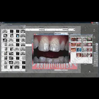 Программное обеспечение для обработки снимков зубов Quickvision