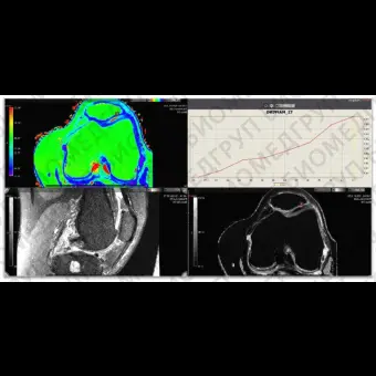 Информационная рабочая станция для медицинских снимков Vitrea Advanced Visualization