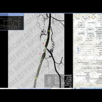 Программное обеспечение для ангиографии CAAS XA