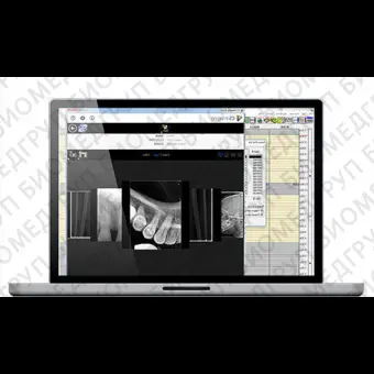 Программное обеспечение для обработки снимков зубов CS Imaging version 8