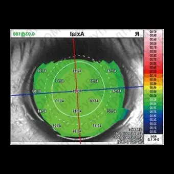 Роговичный топограф OPDScan III VS
