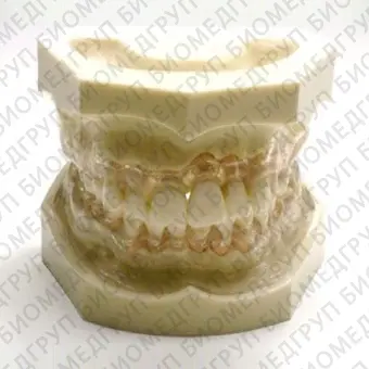 Анатомическая модель прорезывание зубов SP014